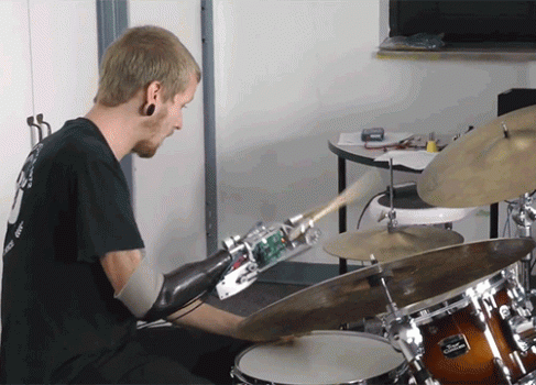 Однорукий барабанщик играет благодаря бионическому протезу